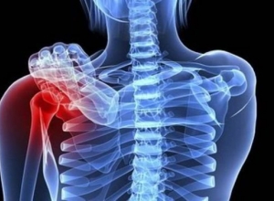 Cảnh báo 8 dấu hiệu ung thư xương vai bạn có thể dễ dàng phát hiện nhất